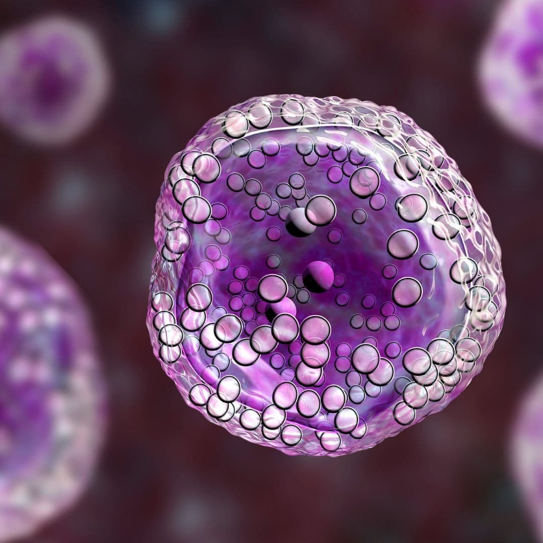 Diagnosis Guide for Non-Hodgkin Lymphoma