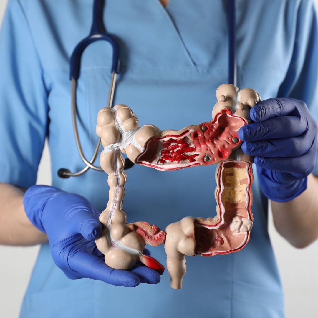 A Guide to the Diagnostic Process for Colorectal Cancer