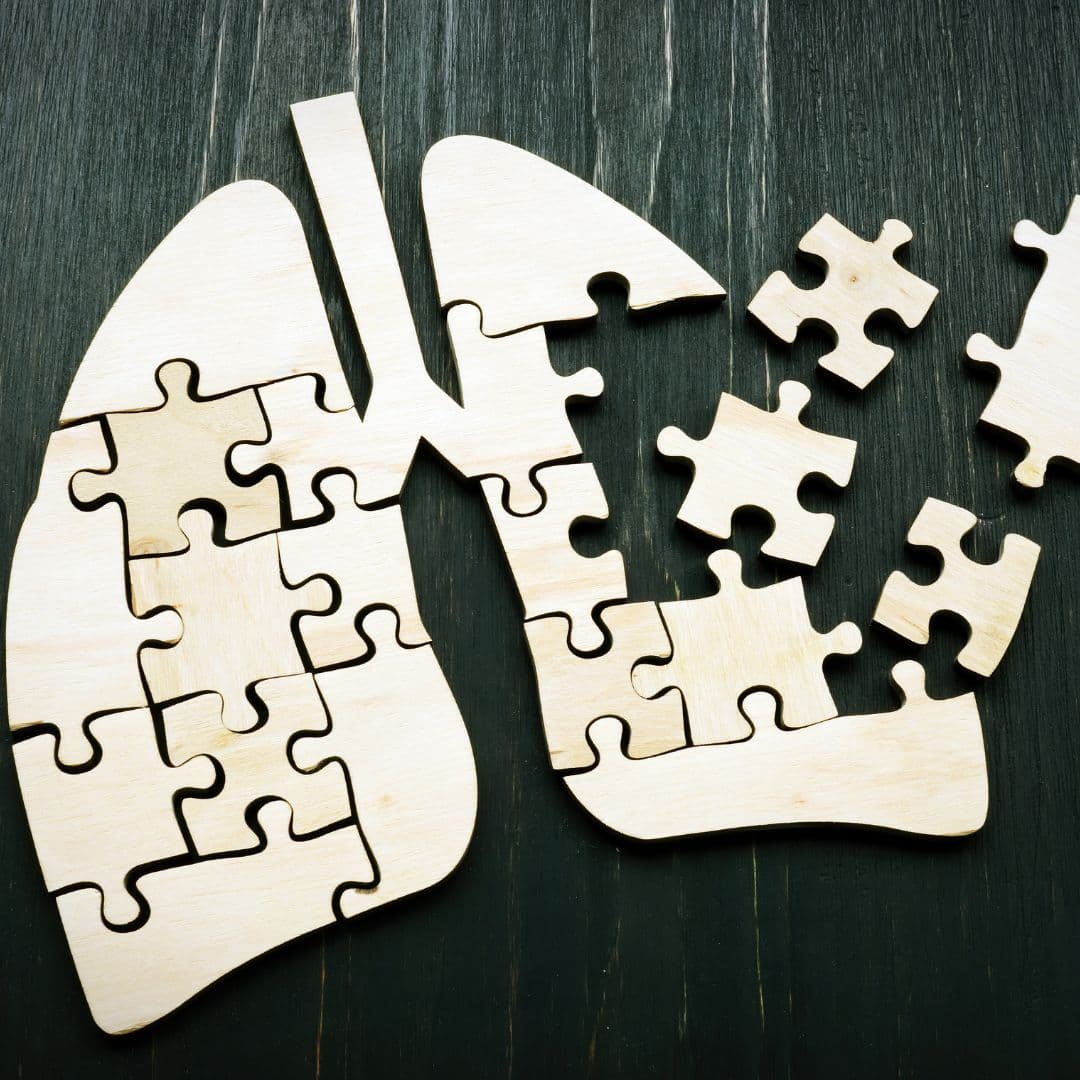 Must-Have Items for Going Through Lung Cancer Treatment